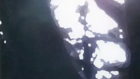 ぶれんど